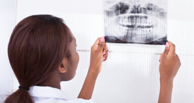 Formation à la radioprotection des patients lors de l’ADF