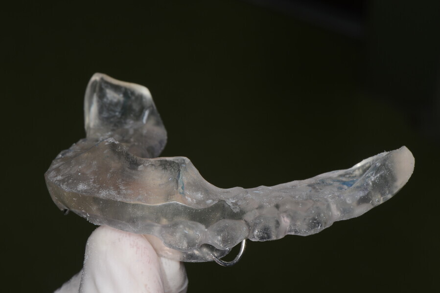 Fig. 29e