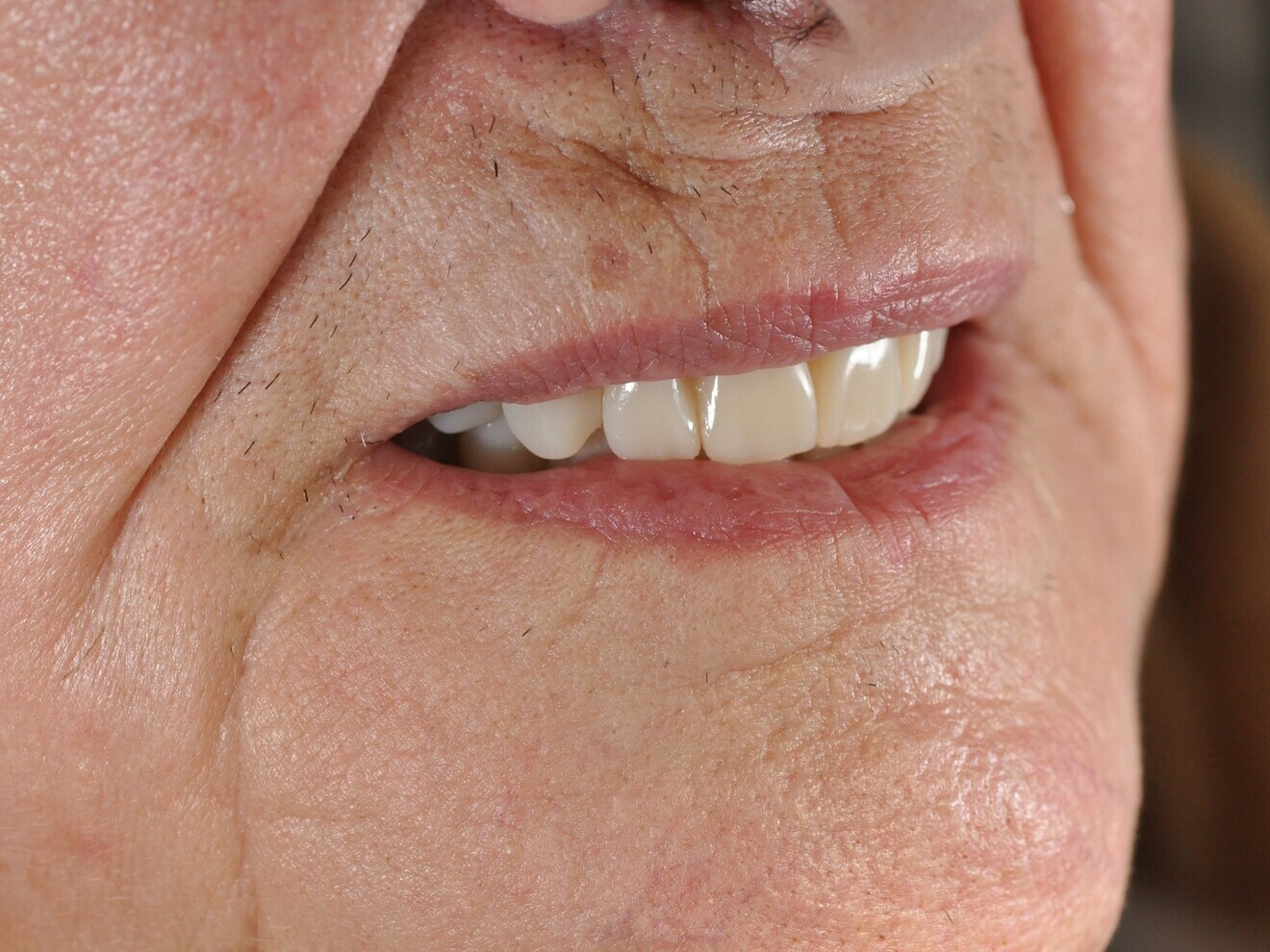 Fig. 13: Detail of the morphology and texture of the anterior teeth at four weeks.