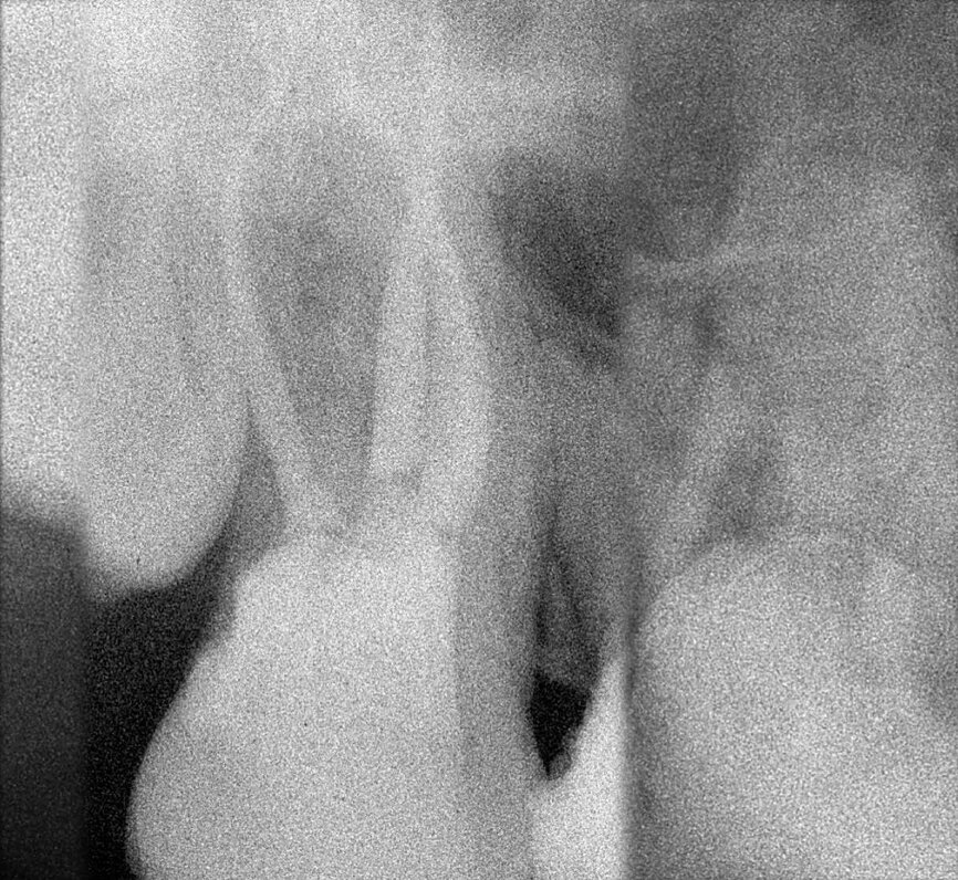 Figure 19