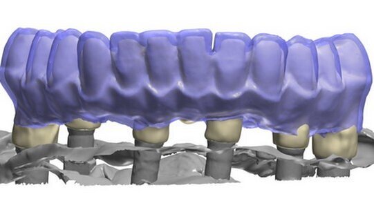 Il parere dell’Odontotecnico sui flussi di lavoro nei laboratori