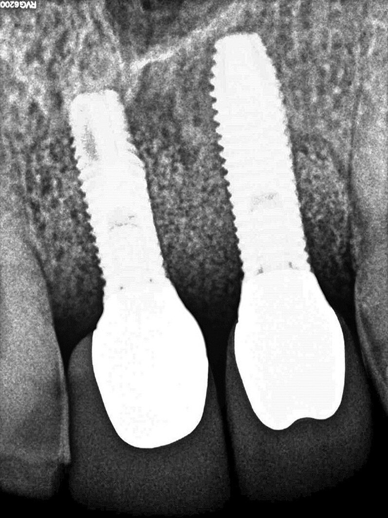Fig. 10
