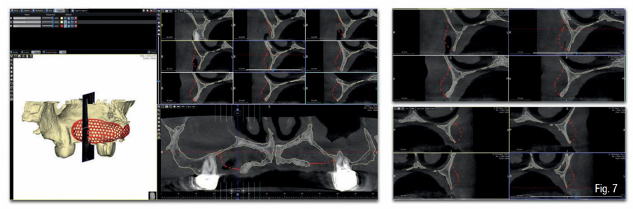 Fig. 7