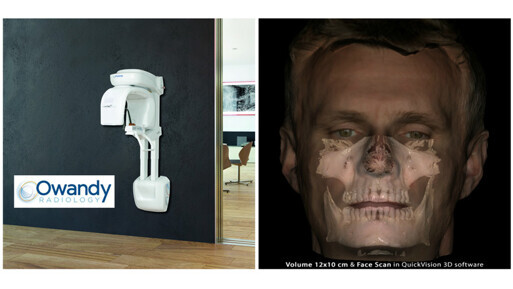 Owandy Radiology’s I-Max 3D receives FDA clearance