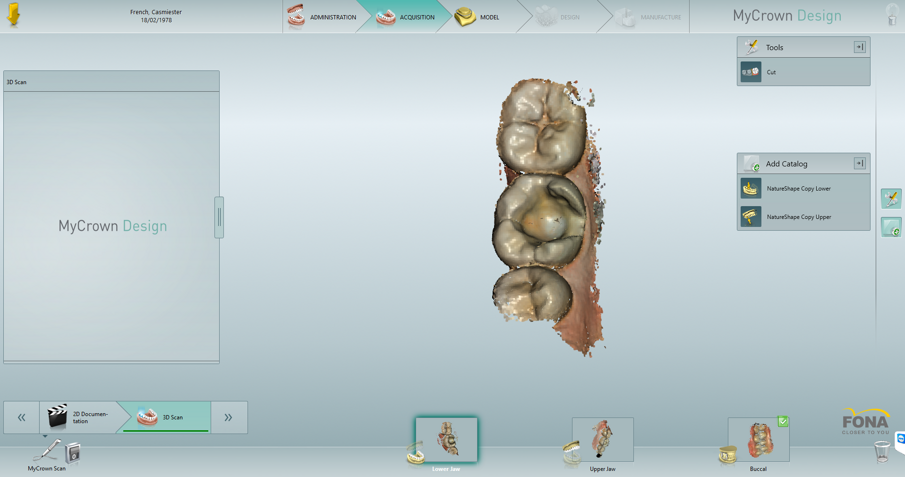 Fig. 4: Lower jaw