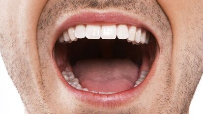 Oral bacteria could be responsible for foodborne infection