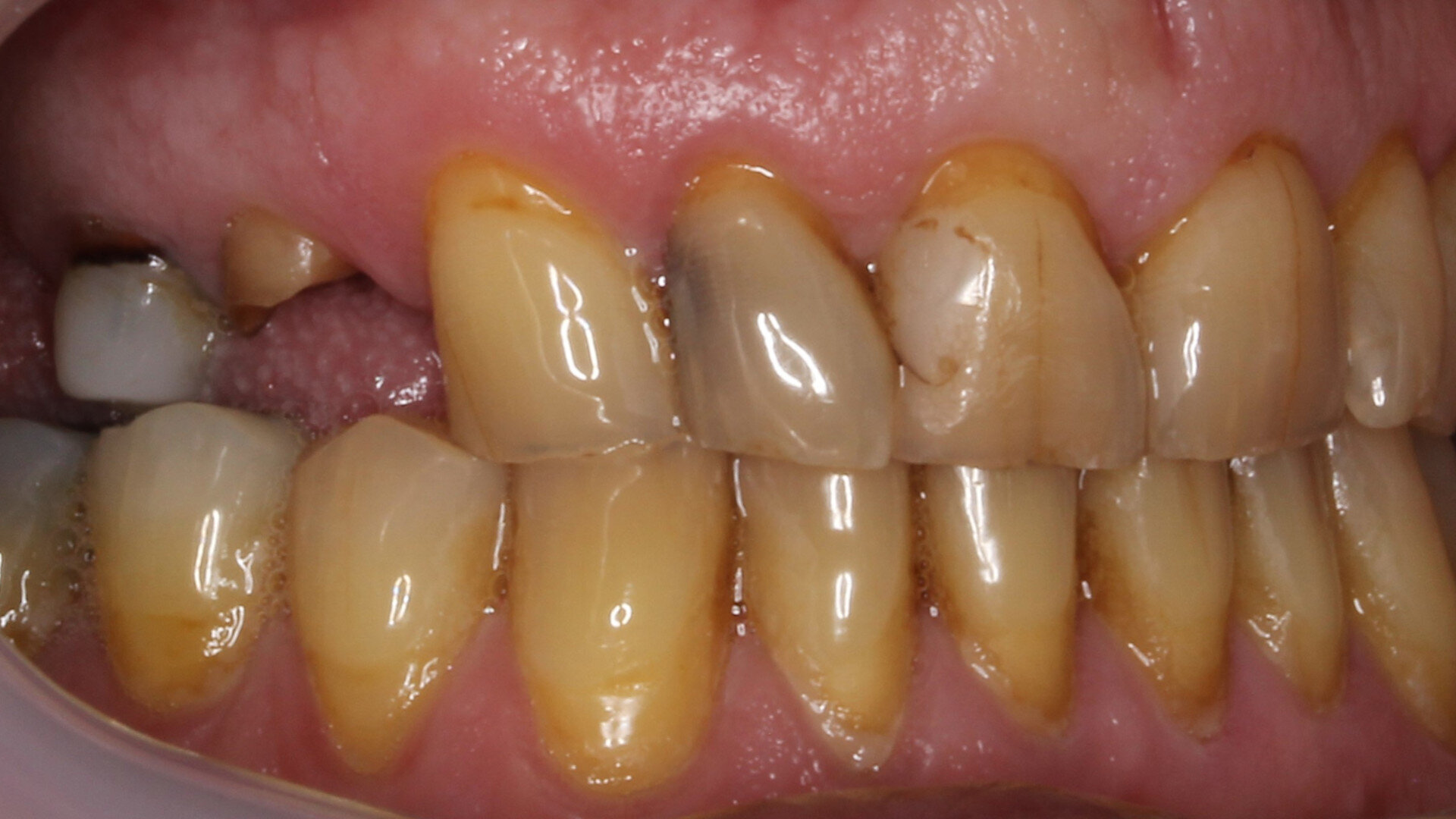 Unconventional applications of dental 3D printing