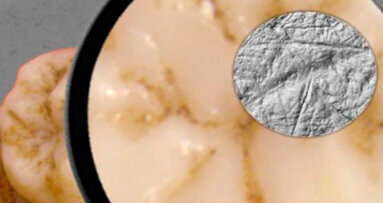 L’analisi dei denti mostra i vantaggi dell’uomo moderno su quello di Neanderthal
