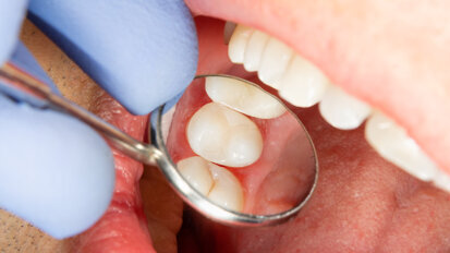 Transforming dentistry:&nbsp;Direct restoration procedures simplified