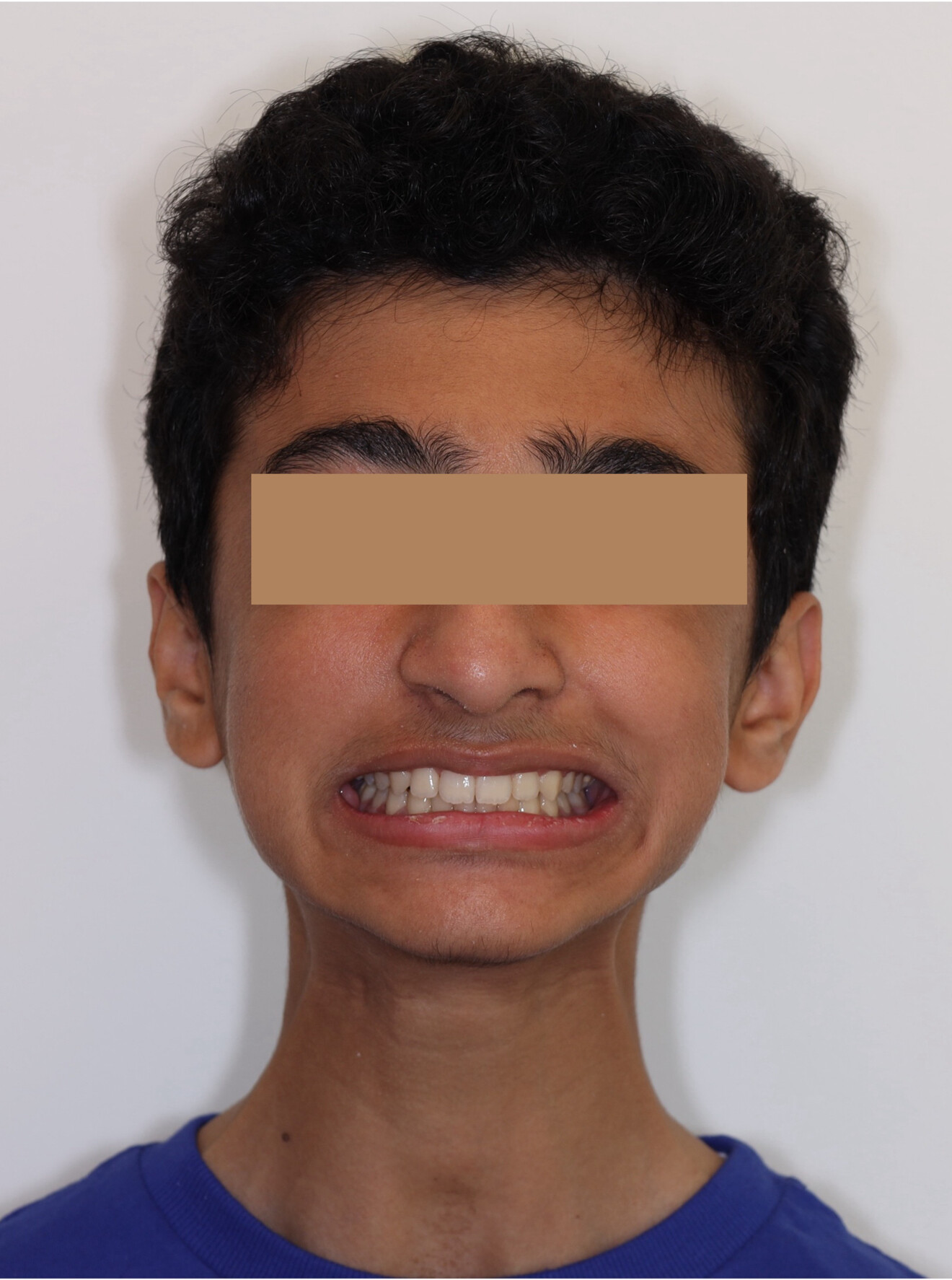 Fig. 7c