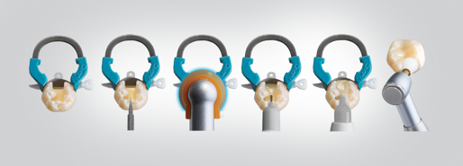 The Class II Solution