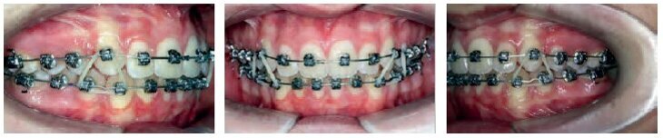 Case01_11