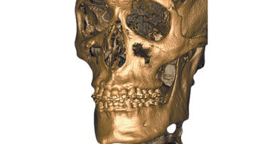 CBCT-Webinar: Voordelen van 3D Imaging integratie in uw praktijk