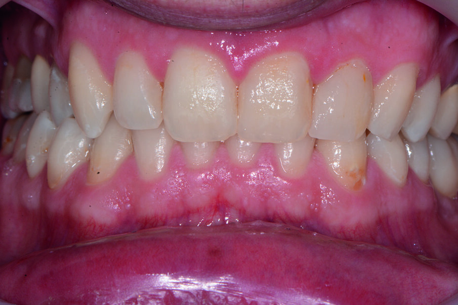 Fig. 1b