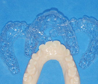 ECLINGER TREATMENT
