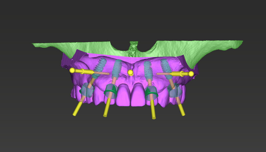 Fig. 8