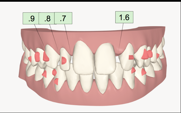 Fig. 1e
