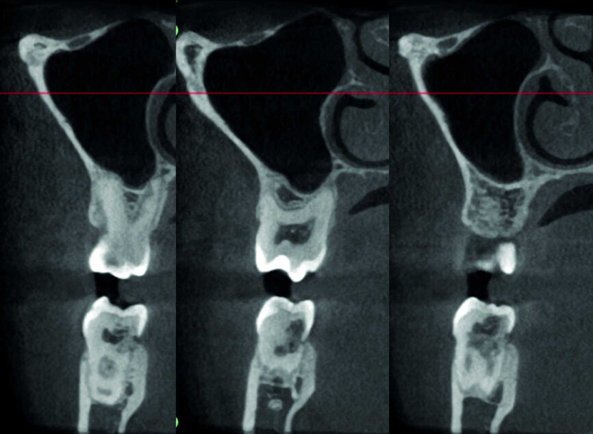 Figure 21