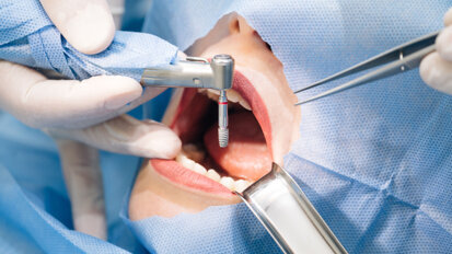 Oral implantology specialist shares expertise on bone growth concept