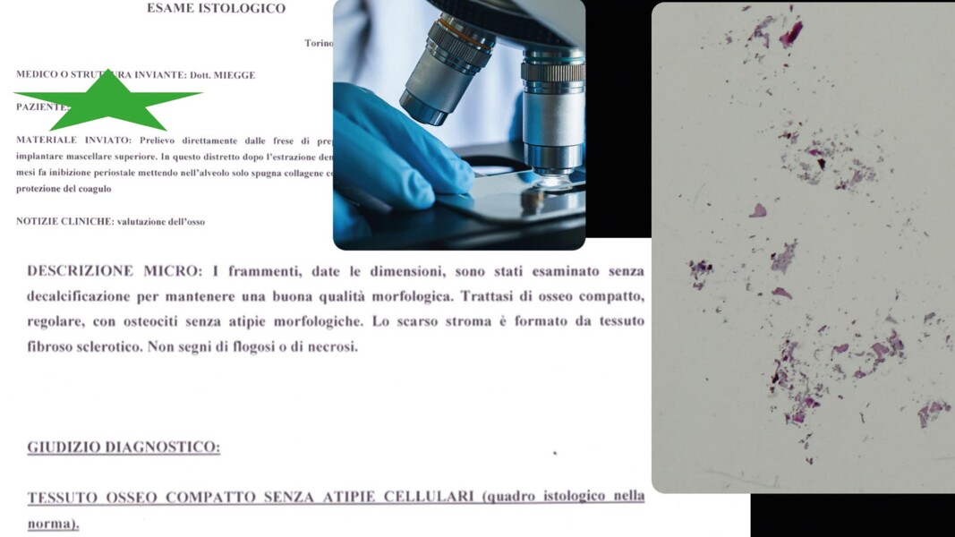 Fig. 5_Esame istologico.