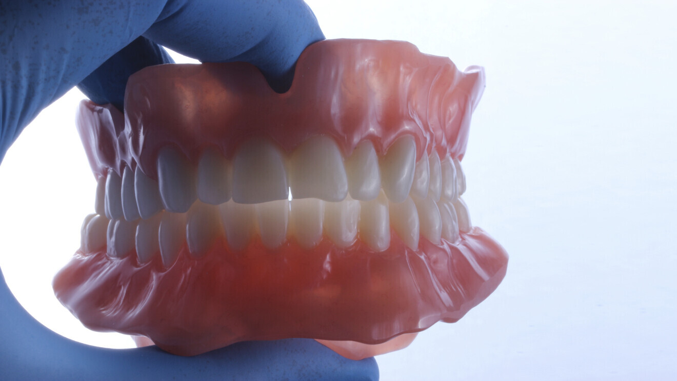 Fig. 11 : Prothèse d’usage imprimée en 3D.