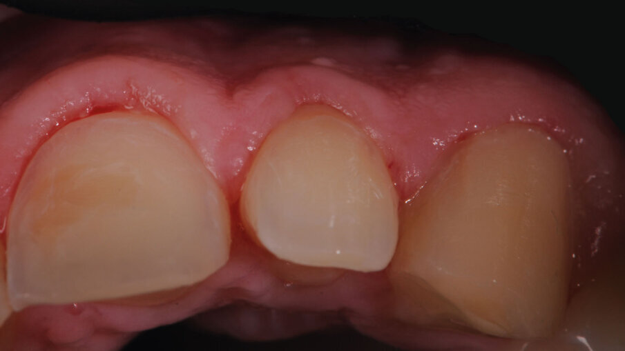 Fig. 9