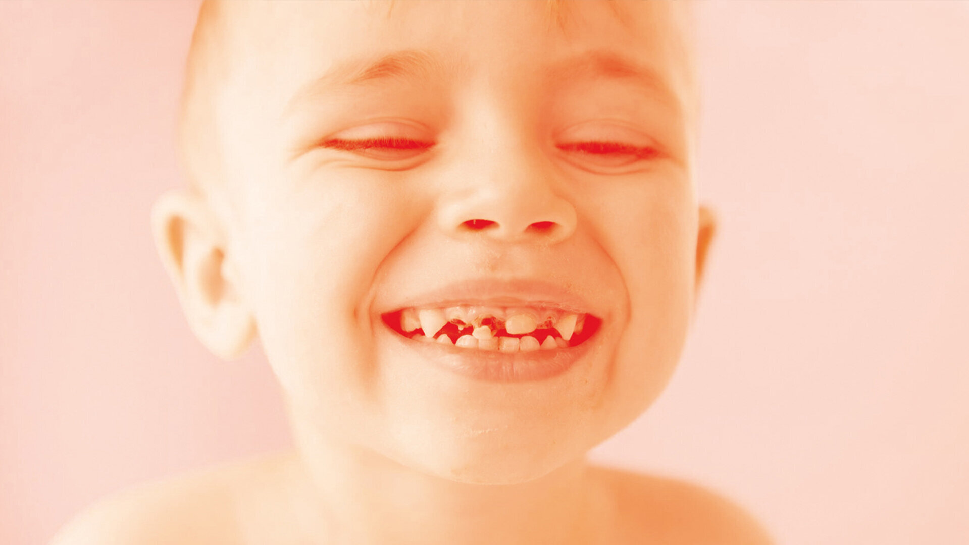 DT News - Pakistan - New strategies unveiled to combat tooth decay in ...