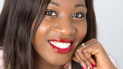Gold standard for chairside restorations