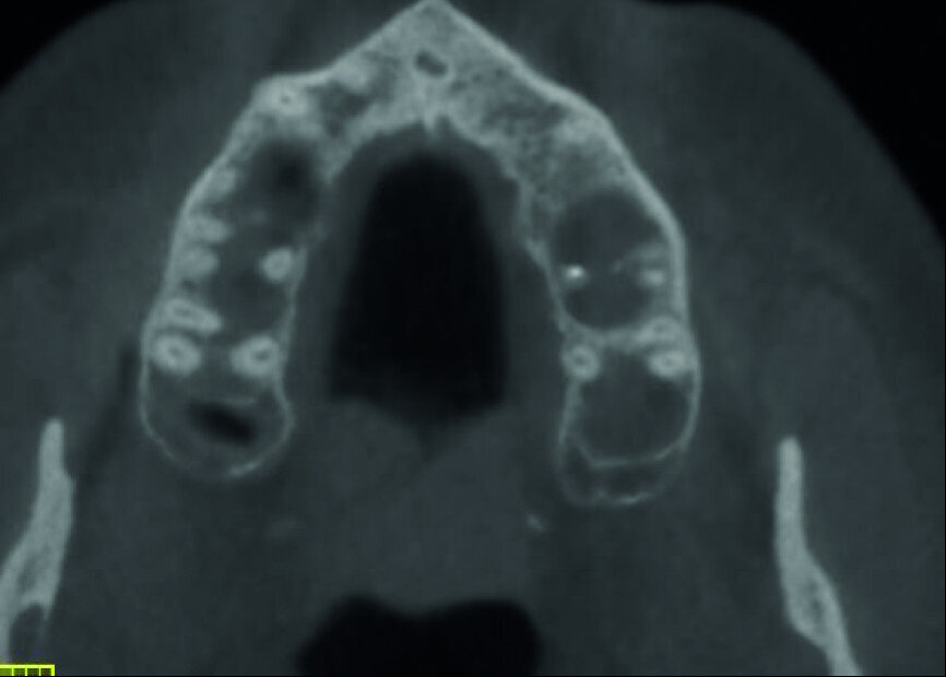 Fig.: 4