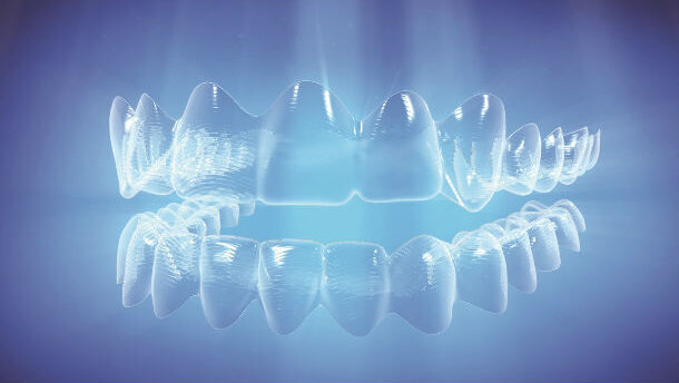 Invisalign, nuove funzioni SmartForce per supportare gli specialisti nel trattamento dei casi più complessi: disponibili per Invisalign Full, Teen e Lite