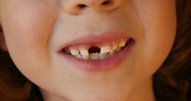 Meeste kinderen ervaren verlies eerste melktand positief