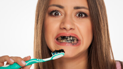 Dentists discourage the use of charcoal toothpaste