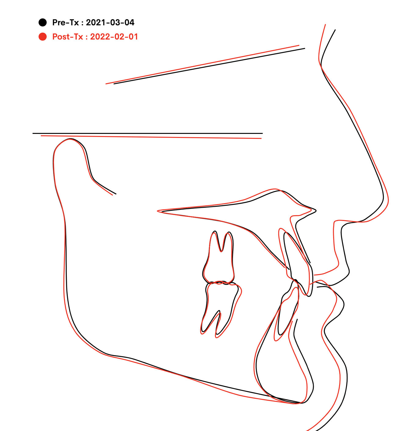 Fig. 36