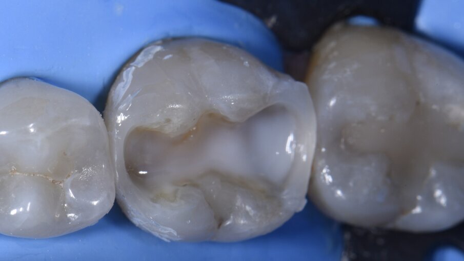 Fig. 6