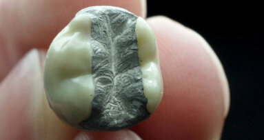 Alternative medicine used to cure amalgam-attributed health complaints