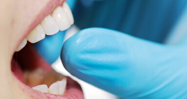 PANAVIA family: Three options, all general cementation needs covered