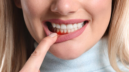 Periodontics a step closer to gaining EU-wide recognition