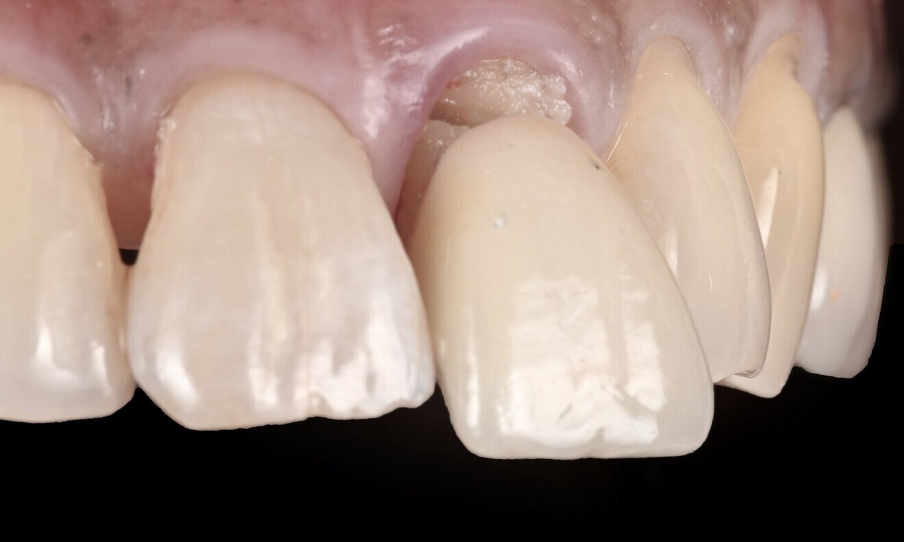 Fig. 3
