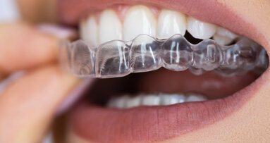 Streamlining clear aligner therapy–Success without attachments using the Progressive Smile Makeover Concept