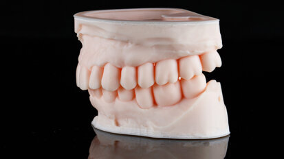 3D-printing acquisition may help Align Technology to break the mould
