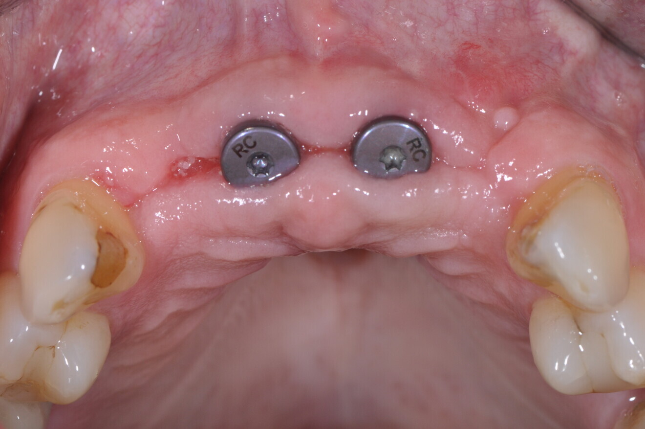 Fig. 13b.