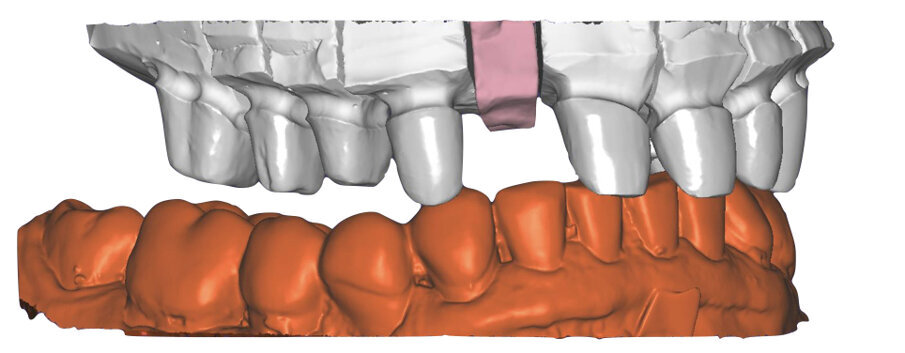 Fig. 56