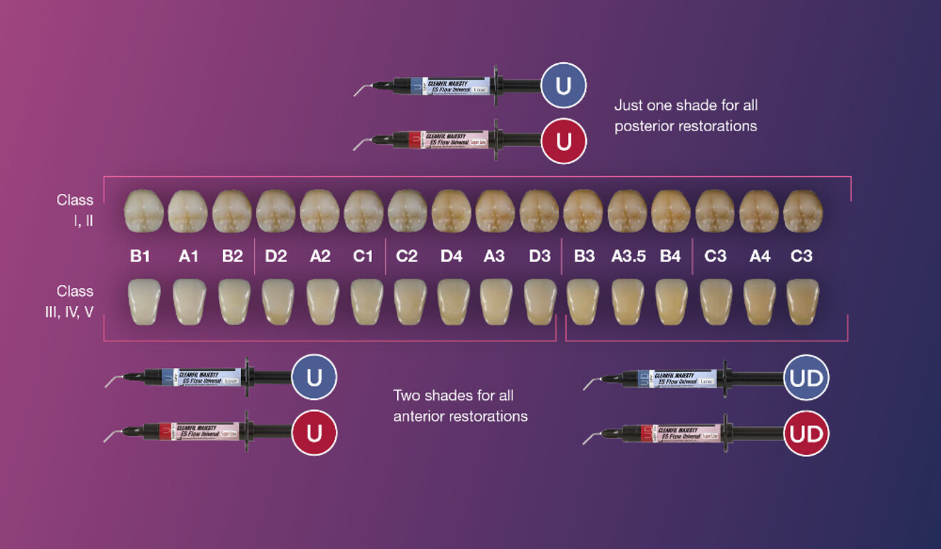 Colour matching with anterior and posterior restorations. 