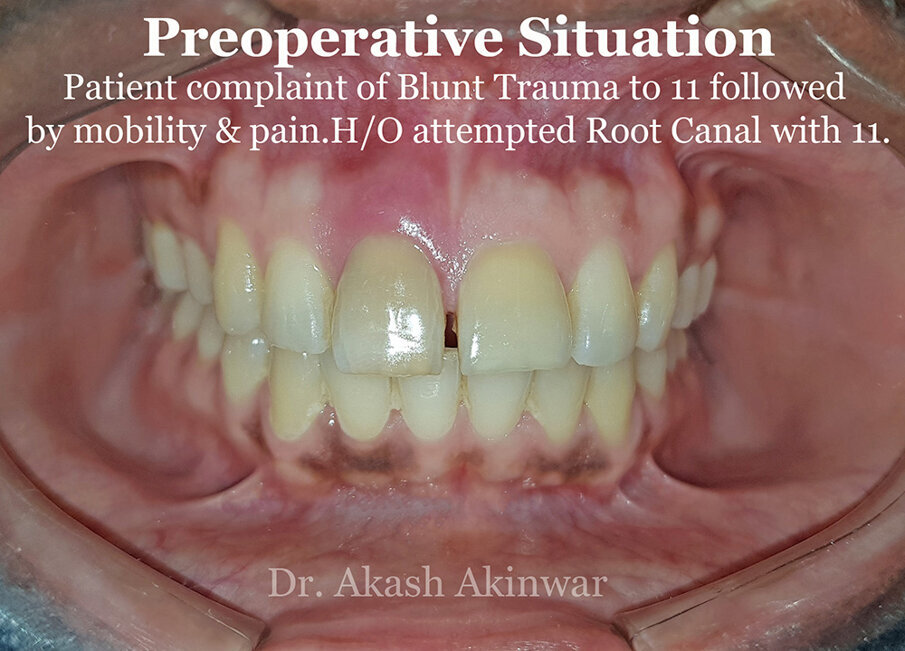 Fig 1: Pre-operative situation of 11