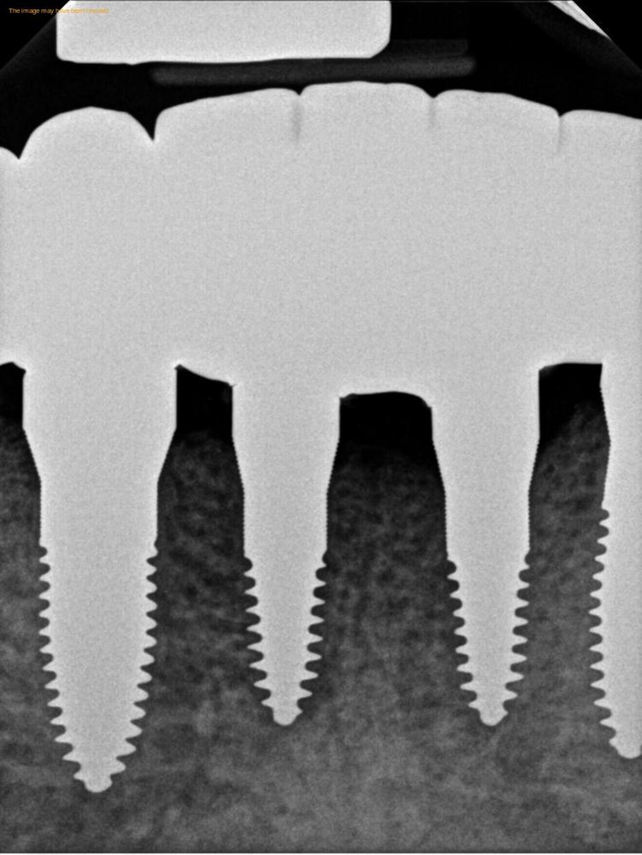 Fig. 17b.