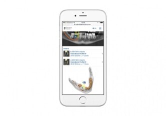 Dentsply Sirona – mySimplant Planning Service