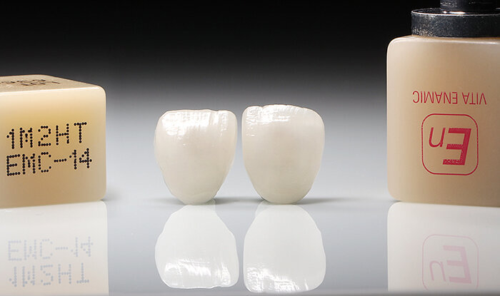 Fig. 12: The finished veneers just before the clinical try-in.