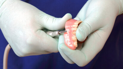 Estudo sugere que prótese dentária afeta saúde cardiovascular