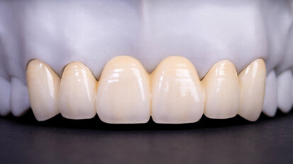 The growing opportunity in anterior esthetic dentistry