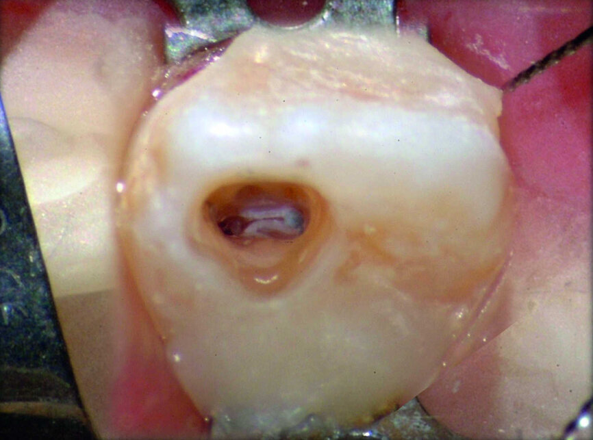Figure 34